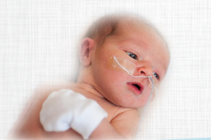 Strategies For Feeding The Preterm Infant